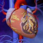 Baja el índice de edad en infartos al miocardio
