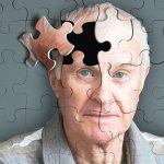 ¿Qué es el Alzheimer y cuáles son los síntomas de esta enfermedad?