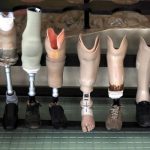 Hospital civil pone en marcha proyecto para realizar prótesis