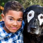 Un niño sale de la depresión al conocer a un perro con su misma enfermedad