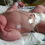 Mujer da a luz a una bebé de tan solo 6 kilos en Florida
