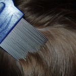 Exhortan a prevenir contagio de piojos