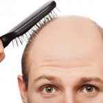 Hormonas, genes y estrés pueden arrancar cabelleras