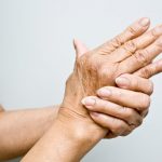 Artritis reumatoide afecta productividad
