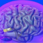 Implante cerebral podría aumentar la memoria en un 30%