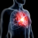 Paro cardíaco e infarto ¿es lo mismo? – Veracidad News